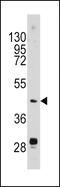 Plasminogen Activator, Urokinase antibody, MBS9202443, MyBioSource, Western Blot image 