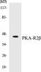 Protein Kinase CAMP-Dependent Type II Regulatory Subunit Beta antibody, EKC1462, Boster Biological Technology, Western Blot image 