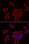 Purinergic Receptor P2X 4 antibody, STJ28765, St John