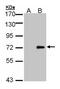 Unc-51 Like Kinase 4 antibody, NBP2-20809, Novus Biologicals, Western Blot image 
