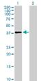 Tsukushi, Small Leucine Rich Proteoglycan antibody, H00025987-B01P, Novus Biologicals, Western Blot image 