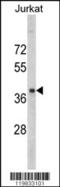 Ribonucleotide Reductase Regulatory Subunit M2 antibody, 62-363, ProSci, Western Blot image 