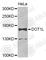 DOT1 Like Histone Lysine Methyltransferase antibody, A7619, ABclonal Technology, Western Blot image 