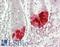Pseudopodium Enriched Atypical Kinase 1 antibody, LS-B14702, Lifespan Biosciences, Immunohistochemistry paraffin image 