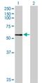 Cytochrome P450 Family 3 Subfamily A Member 7 antibody, H00001551-D01P, Novus Biologicals, Western Blot image 