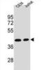 Adenosine Deaminase antibody, abx025496, Abbexa, Western Blot image 