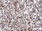 Secretory Carrier Membrane Protein 2 antibody, M08823, Boster Biological Technology, Immunohistochemistry paraffin image 