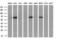 Cbl Proto-Oncogene C antibody, M03693, Boster Biological Technology, Western Blot image 