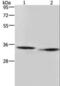 Amidohydrolase Domain Containing 2 antibody, LS-C404503, Lifespan Biosciences, Western Blot image 