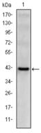 Killer Cell Lectin Like Receptor D1 antibody, abx015806, Abbexa, Enzyme Linked Immunosorbent Assay image 