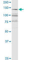 Arginine-Glutamic Acid Dipeptide Repeats antibody, LS-C196709, Lifespan Biosciences, Western Blot image 