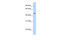 Transducin beta-like protein 2 antibody, 26-816, ProSci, Western Blot image 