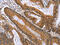 Activin receptor type-2B antibody, CSB-PA206692, Cusabio, Immunohistochemistry paraffin image 