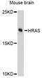 HRas Proto-Oncogene, GTPase antibody, A12212, ABclonal Technology, Western Blot image 