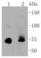 Protein Kinase C Alpha antibody, A00743, Boster Biological Technology, Western Blot image 