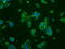B-Raf Proto-Oncogene, Serine/Threonine Kinase antibody, GTX84806, GeneTex, Immunofluorescence image 