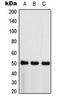 C-Terminal Src Kinase antibody, LS-C353951, Lifespan Biosciences, Western Blot image 