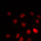 Peroxisome Proliferator Activated Receptor Gamma antibody, LS-C368478, Lifespan Biosciences, Immunofluorescence image 
