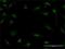 S100 Calcium Binding Protein A7 antibody, H00006278-M01, Novus Biologicals, Immunocytochemistry image 