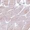 EPS8 Like 2 antibody, PA5-59447, Invitrogen Antibodies, Immunohistochemistry frozen image 