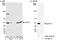 Eukaryotic Translation Elongation Factor 1 Gamma antibody, A300-735A, Bethyl Labs, Immunoprecipitation image 