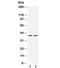 Mitogen-Activated Protein Kinase Kinase 3 antibody, R32106, NSJ Bioreagents, Western Blot image 