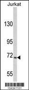 Ubiquitin Specific Peptidase 19 antibody, 61-110, ProSci, Western Blot image 