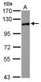 Huntingtin Interacting Protein 1 Related antibody, LS-C155473, Lifespan Biosciences, Western Blot image 