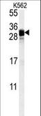 Fibroblast Growth Factor 7 antibody, LS-C166139, Lifespan Biosciences, Western Blot image 