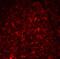 Thymic Stromal Lymphopoietin antibody, A01096-3, Boster Biological Technology, Immunofluorescence image 