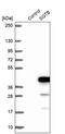 Small Glutamine Rich Tetratricopeptide Repeat Containing Beta antibody, PA5-60795, Invitrogen Antibodies, Western Blot image 