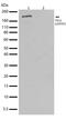 TSC Complex Subunit 2 antibody, 710395, Invitrogen Antibodies, Western Blot image 