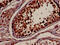 Tyrosine 3-Monooxygenase/Tryptophan 5-Monooxygenase Activation Protein Beta antibody, CSB-PA01544A0Rb, Cusabio, Immunohistochemistry paraffin image 