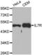 Interleukin 7 Receptor antibody, abx001142, Abbexa, Western Blot image 