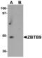 Zinc Finger And BTB Domain Containing 9 antibody, LS-C144308, Lifespan Biosciences, Western Blot image 