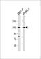 MORC family CW-type zinc finger protein 2 antibody, A05664, Boster Biological Technology, Western Blot image 
