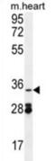Oxidoreductase NAD Binding Domain Containing 1 antibody, abx026257, Abbexa, Western Blot image 