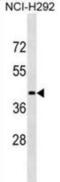 Lipase Family Member N antibody, abx029095, Abbexa, Western Blot image 