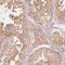 Ubiquitin Conjugating Enzyme E2 L3 antibody, NBP2-49367, Novus Biologicals, Immunohistochemistry paraffin image 