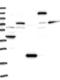 Ubiquitin Protein Ligase E3C antibody, NBP1-81558, Novus Biologicals, Western Blot image 