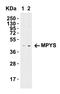 Transmembrane Protein 173 antibody, A01871-1, Boster Biological Technology, Western Blot image 