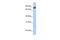 Gamma-Glutamyltransferase 7 antibody, PA5-43301, Invitrogen Antibodies, Western Blot image 