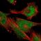 TRNA Methyltransferase 10B antibody, HPA021800, Atlas Antibodies, Immunofluorescence image 