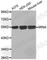 MDIG antibody, A2334, ABclonal Technology, Western Blot image 