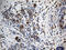 GIPC PDZ Domain Containing Family Member 1 antibody, LS-C796193, Lifespan Biosciences, Immunohistochemistry paraffin image 