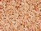 DEAD-Box Helicase 3 X-Linked antibody, LS-C369547, Lifespan Biosciences, Immunohistochemistry paraffin image 