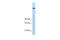 Lysine Demethylase 3B antibody, 29-035, ProSci, Enzyme Linked Immunosorbent Assay image 