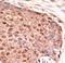 Zinc Finger MIZ-Type Containing 1 antibody, LS-C100483, Lifespan Biosciences, Immunohistochemistry paraffin image 