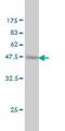 Protein C Receptor antibody, ab56689, Abcam, Western Blot image 