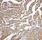 TNC antibody, PA5-80171, Invitrogen Antibodies, Immunohistochemistry paraffin image 